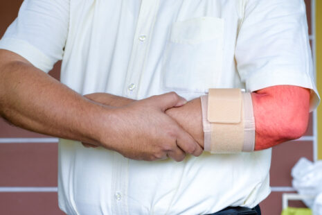 What Is The Fastest Way To Cure Tennis Elbow