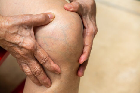 Will Knee Pain Go Away?