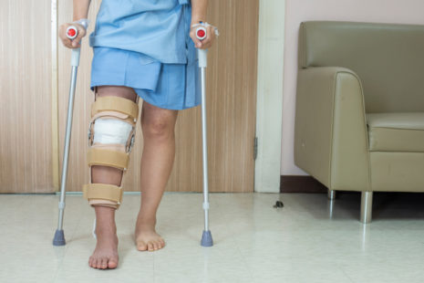 Should You Avoid Walking On A Torn ACL?